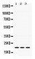 Anti-GTPase HRAS Antibody